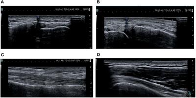 Effectiveness of Ultrasound Imaging in Assessing the Palpation Skills of Rotating Physicians